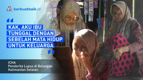 Hidup dengan Satu Mata, Ibu Penderita Lupus Berjuang untuk Keluarga