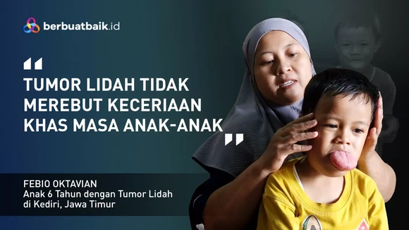 Hidup dengan Tumor Lidah di Usia 6 Tahun, Kisah Febio yang Tetap Ceria