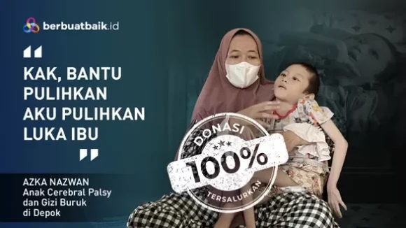 Kisah Pilu Azka, Alami Cerebral Palsy hingga Tinggal Tulang Berbungkus Kulit