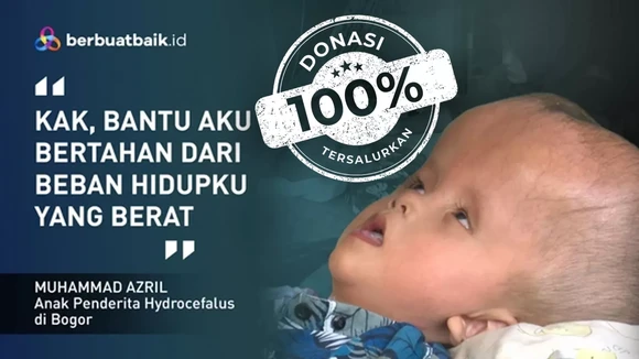 Kisah Sedih Anak Pekerja Serabutan, Alami Hidrosefalus dengan Tubuh Tak Berdaya