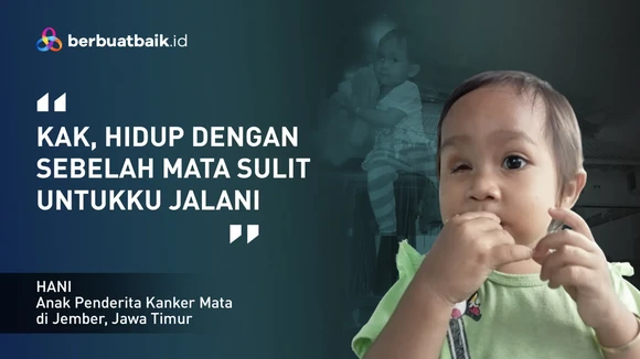 Kisah Sedih Anak Petani Usia 3 Tahun yang Kehilangan Bola Mata Akibat Kanker