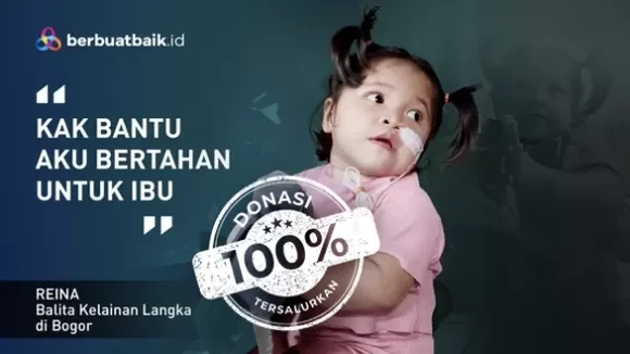 Lawan Kelainan Langka, Balita Ini Hilang Penglihatan hingga Memori