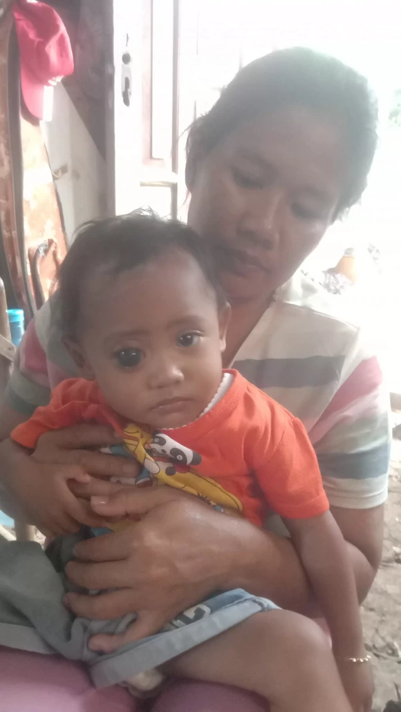 Mengalami Glaukoma Sejak Lahir, Balita Wulan Tidak Kehilangan Harapan