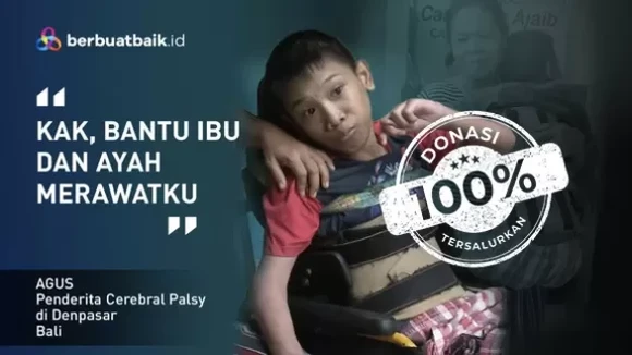 Mimpi Anak Juru Parkir yang Cerebral Palsy untuk Sembuh dan Tak Digunjing