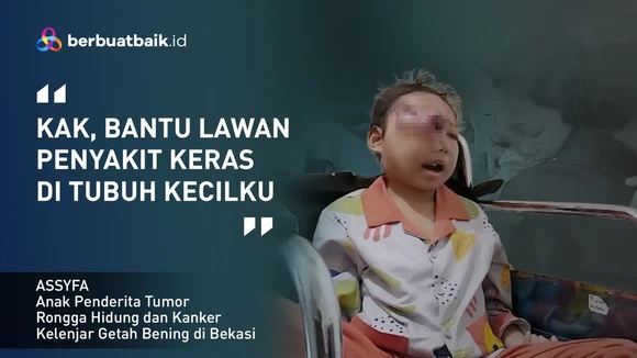 Nasib Malang Anak Tukang Kebun Semakin Kurus Idap Tumor hingga Kanker