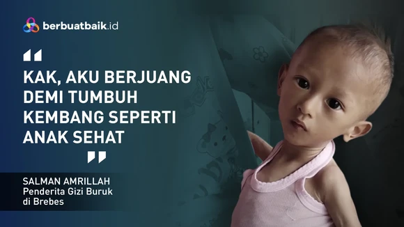 Sedihnya Adik Salman Begitu Kurus hingga Tak Bisa Tegakkan Leher karena Gizi Buruk