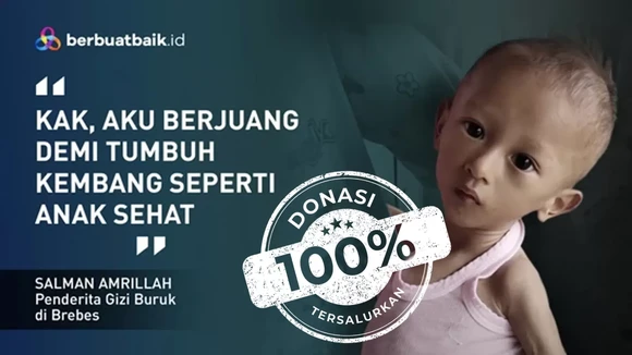 Sedihnya Adik Salman Begitu Kurus hingga Tak Bisa Tegakkan Leher karena Gizi Buruk