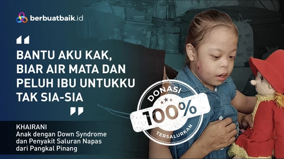 Sering Melukai Diri, Anak Down Syndrome Ini Merantau ke Jakarta Cari Kesembuhan