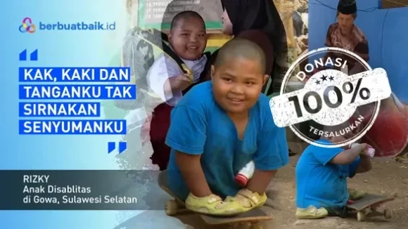 Tanpa Kaki Tangan Sempurna, Anak Pembuat Kusen Hidup Tegar Ajarkan Persahabatan