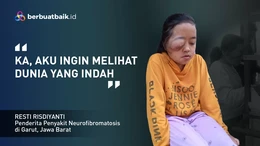 Anak Tukang Batagor Alami Tumor Punya Asa Melihat Indahnya Dunia