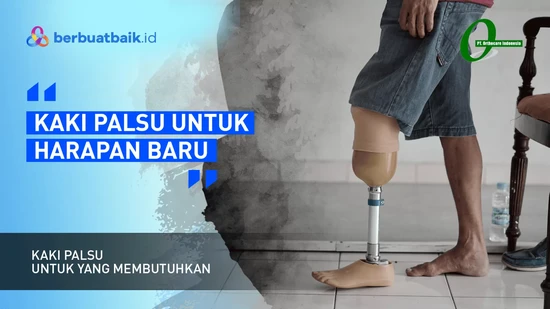 Awali Sebuah Langkah dengan Kaki Palsu, Demi Pendidikan dan Kehidupan Lebih Baik