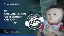 Balita Penderita Hidrosefalus Butuh Operasi Rekonstruksi Kepala