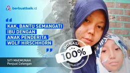 Bantu Perjuangan Ibu Penjual Celengan dengan Anak Penderita Wolf Hirschhorn