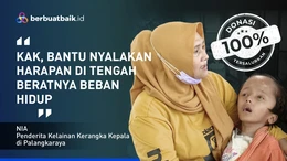 Derita Anak Kelainan Kerangka Kepala Selalu Digendong Ibunya Berjualan Keripik