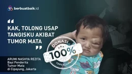 Derita dan Tangis Anak Penjual Bihun Gulung Pengidap Tumor Mata
