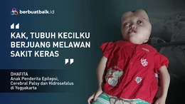Dhafita, Pejuang Kecil dengan Hidrosefalus, Epilepsi hingga Cerebral Palsy