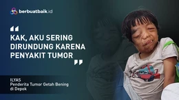 Dirundung Mirip Alien, Anak Tukang Ojek Ingin Hidup dengan Rasa Aman