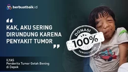 Dirundung Mirip Alien, Anak Tukang Ojek Ingin Hidup dengan Rasa Aman