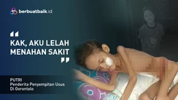 Hampir Setahun di Rumah Sakit, Putri Berjuang Sembuh dari Penyempitan Usus