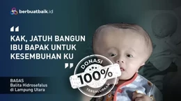 Jatuh Bangun Kuli Panggul Kayu Sembuhkan Anak Hidrosefalus hingga Jual Apapun