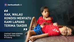 Kembar Siam dengan Perut Menyatu, Syafaat dan Hidayah Tetap Tegar Terima Takdir