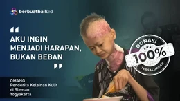 Kisah Pilu Omang Penderita Kelainan Kulit, Kurus Kering hingga Hilang Gigi dan Kuku