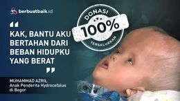 Kisah Sedih Anak Pekerja Serabutan, Alami Hidrosefalus dengan Tubuh Tak Berdaya