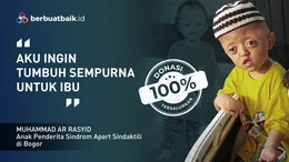 Menderita Sindrom Langka dengan Jari yang Menempel, Anak Buruh Cuci Ini Terus Semangat!