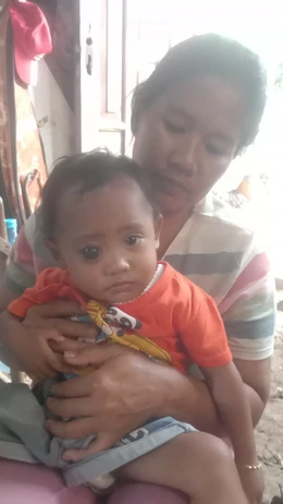 Mengalami Glaukoma Sejak Lahir, Balita Wulan Tidak Kehilangan Harapan