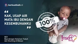 Merana Anak Tukang Somay, Stunting dan BAB dari Ususnya yang Terbuka