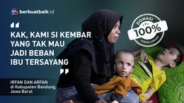 Nasib Pilu Anak Kembar Buruh Pemintal Benang: Alami Hidrosefalus, Cerebral Palsy hingga Epilepsi