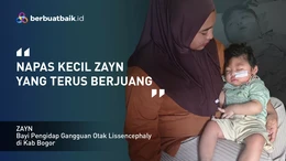Sering Kejang dan Gagal Napas, Zayn Bertahan dengan Gangguan Otak Lissencephaly