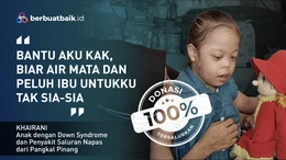 Sering Melukai Diri, Anak Down Syndrome Ini Merantau ke Jakarta Cari Kesembuhan