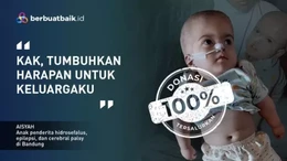Si Kecil Aisyah Ditelantarkan Ayah hingga Derita Hidrosepalus, Epilepsi hingga Cerebral Palsy
