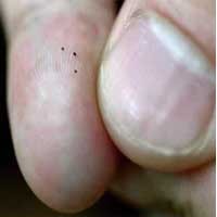 Teknologi RFID  Bantu Paramedis