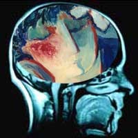 Scan Otak Bantu Baca Pikiran 