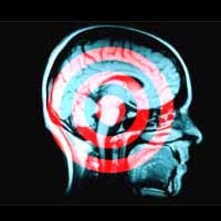 Ponsel Tidak Sebabkan Kanker Otak