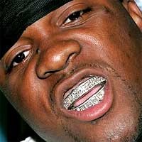 Hobi Baru Seleb: Pasang Berlian di Seluruh Gigi Depan