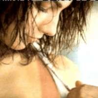 Pertolongan Pertama Luka Bakar