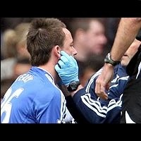 John Terry Tambah Nestapa Chelsea