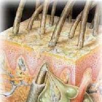 Mengenal Apa itu Jerawat