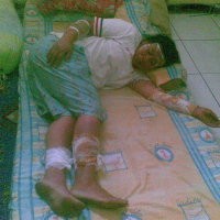 Gas Bocor, Sepasang Suami Istri Terbakar