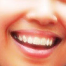 Mau Senyum Menawan? Konsultasikan pada Komputer