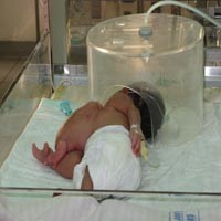 RSU dr Soetomo Kembali Rawat Bayi Siam Tak Komplit