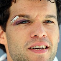 Ballack Tunggu Kontrak Baru