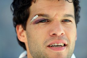 Ballack Tunggu Kontrak Baru