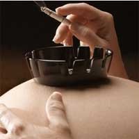 Merokok Berisiko Lahirkan Bayi Berbibir Sumbing