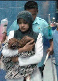 Kembar Siam Dempet Dada Lahir di Pacitan