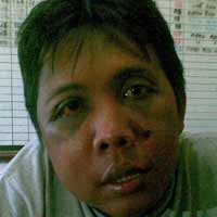 Berdalih Lakukan Ritual, Dukun Palsu Setubuhi 4 Korban 