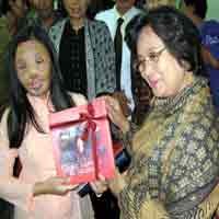 4 Jam Dioperasi, Tim Face Off Keluhkan Jaringan Parut Lisa